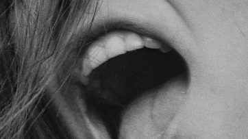 Sonrisa gingival