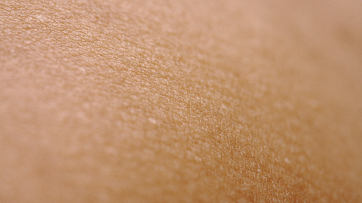 Dermatología clínica